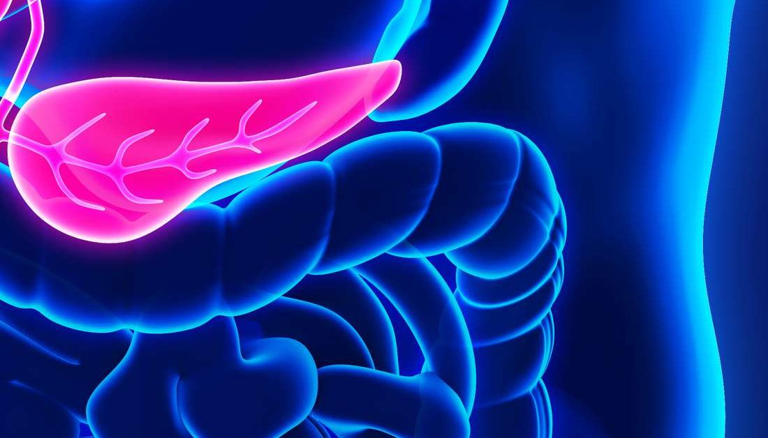 What are the signs of pancreatic cancer?