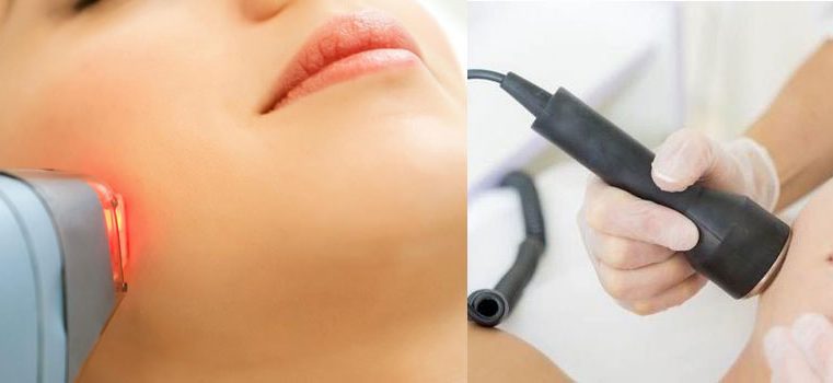 Here Are Various Types of Laser Treatments